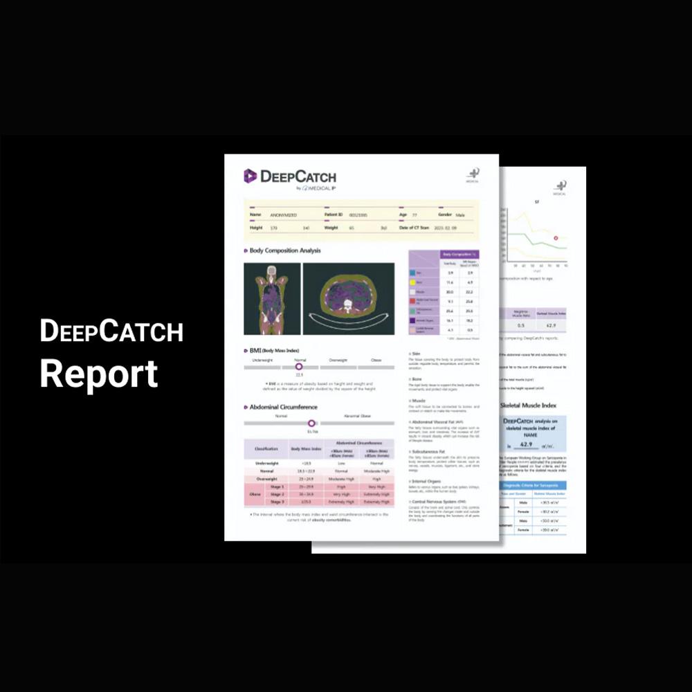 MEDICAL IP DeepCatch